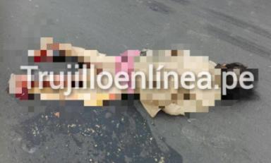 Sus piernas fueron destrozadas. Foto: Trujillo en Línea