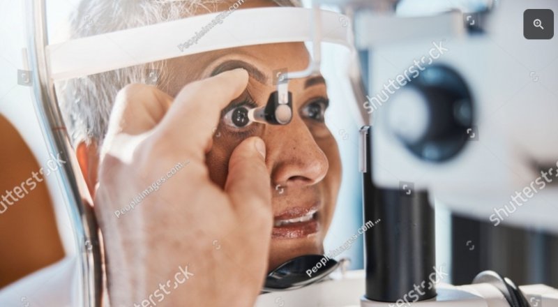 Glaucoma secundario en Perú: causas frecuentes y factores de riesgo