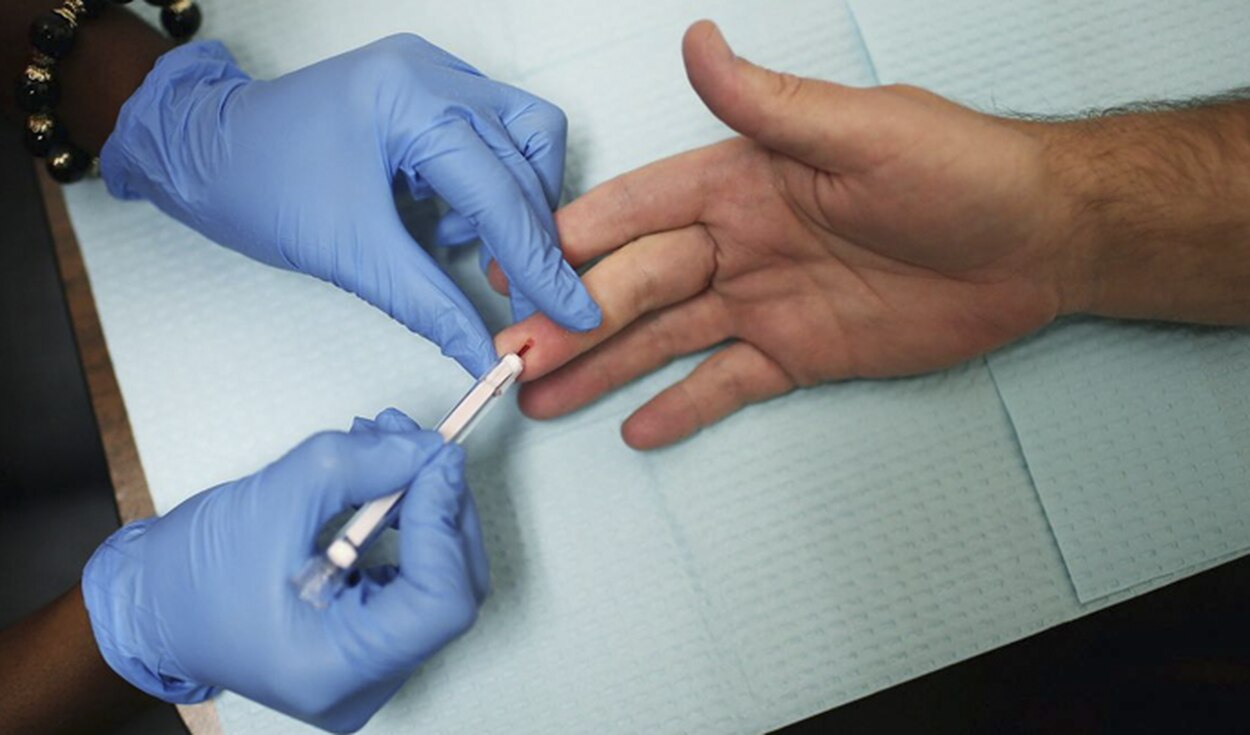 La Libertad: 15 pacientes con VIH fallecieron a causa del coronavirus