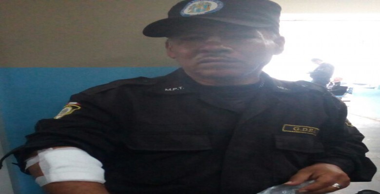 Trujillo: agente municipal resulta grave tras ser agredido por ciudadanos venezolanos