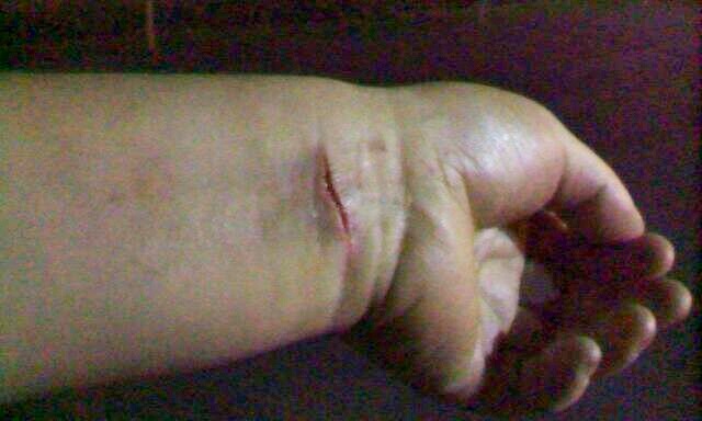 Detienen a sujeto acusado de golpear y amenazar de muerte a expareja