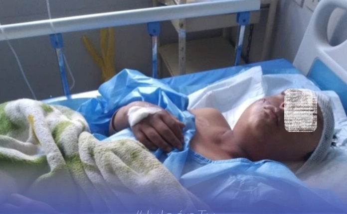 Trujillo: menor de 11 años en estado crítico tras ser atropellado por motociclista en Julcán  foto cortesía Julcán TV