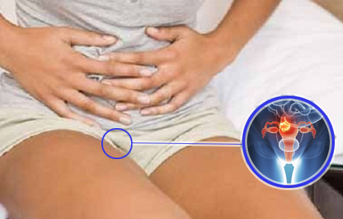 Más de 440 nuevos casos de cáncer se detectaron en el 2014