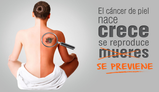 Realizarán campaña de detección y prevención del cáncer a la piel en 15 ciudades del país