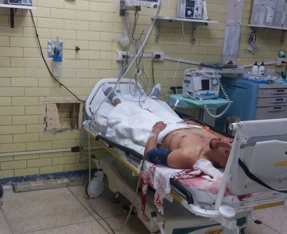 Trujillo: hieren en la cabeza a colombiano en una posible pelea callejera