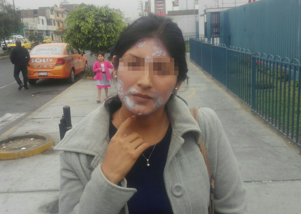 Trujillo: joven denuncia que le quemaron el rostro en clínica dermatológica
