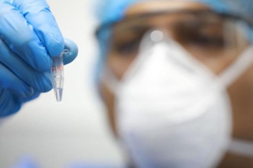 Avanzan negociaciones para compra de la vacuna contra la viruela del mono 