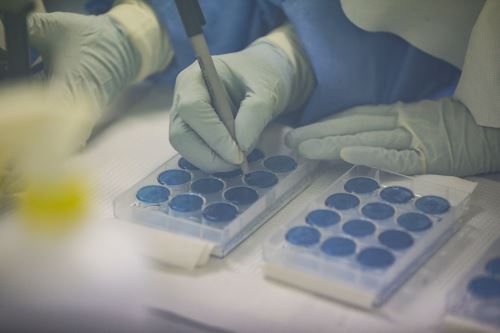 Perú es el único país del mundo donde circulan 4 variantes del covid-19 al mismo tiempo