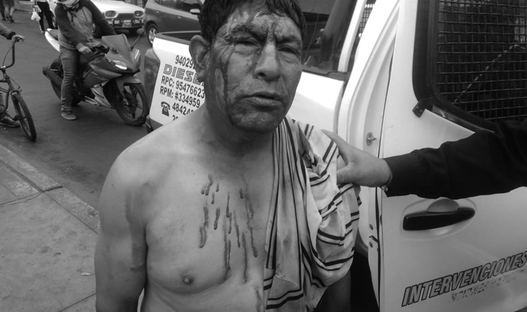 Pelea callejera casi termina con la vida de dos personas en la plazuela Pinillos