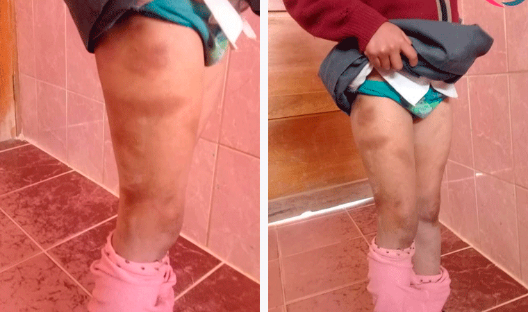 Huamachuco: detienen a mujer por masacrar a su hijastra de 7 años