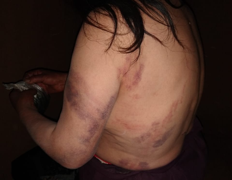 Rondas campesinas de Pataz secuestran a mujeres acusadas de hechicería y Defensoría pide su libertad