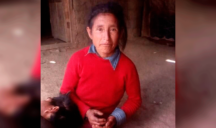 Dieron de alta a madre de familia que resultó herida en Chugay