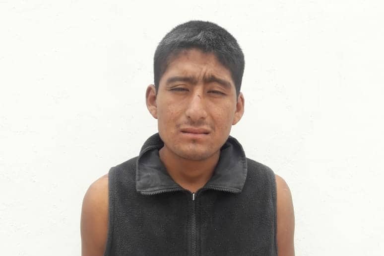 Trujillo: joven casi pierde un dedo al evitar ser violada