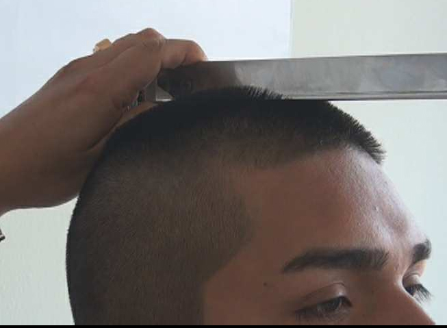 Joven se inyecta silicona para ingresar a PNP