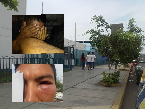 Trujillo: Policías denunciados por desfigurar rostro a joven 