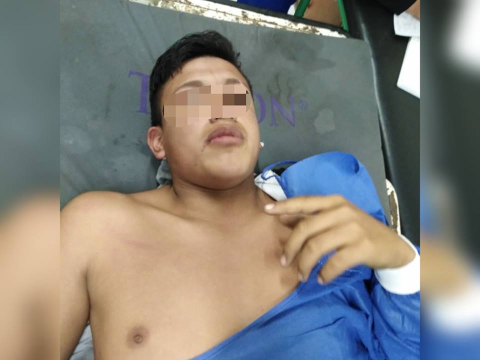 Adolescente se salvó de morir en Infernal balacera de urb. Santo Dominguito