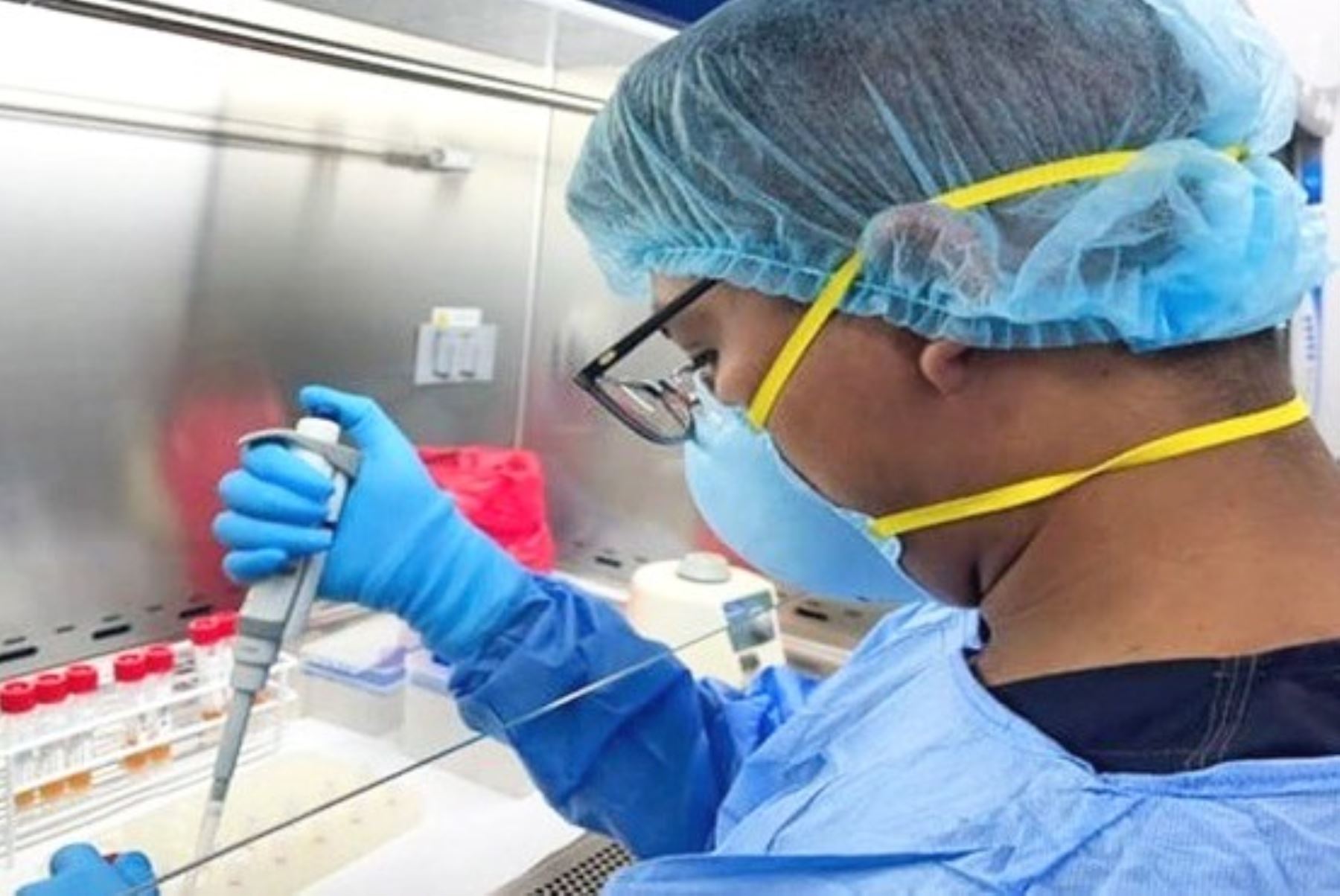 Perú no registra nueva variante de viruela símica