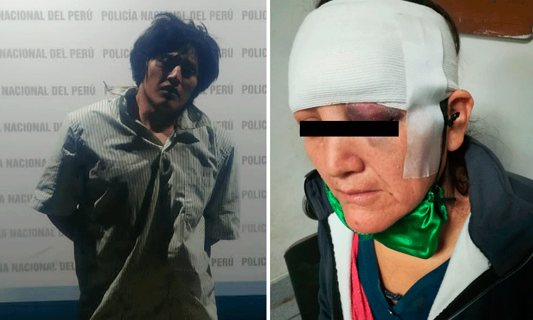 Alto Trujillo: sujeto desfigura el rostro de su madre cuando ella trató de impedir que se drogue