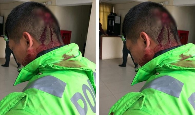 Florencia de Mora: mujer le rompe la cabeza a suboficial cuando intervenía a pareja