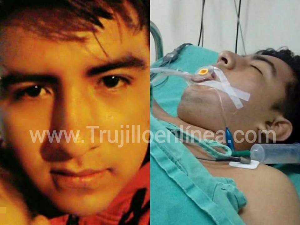 Trujillo: Familia denuncia que médicos de Hospital Belén olvidaron gasa dentro de paciente