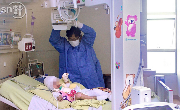 Quemaduras en niños por pirotécnicos aumentan 30 % en fiestas de fin de año  