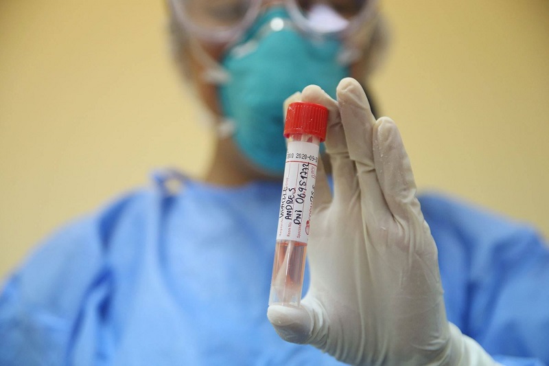 ¿Qué proyectos de pruebas de covid-19 se desarrollan en Perú y por qué son importantes?  