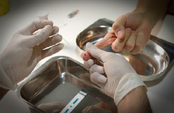 Las 10 preguntas más comunes cuando una persona se hace la prueba de VIH