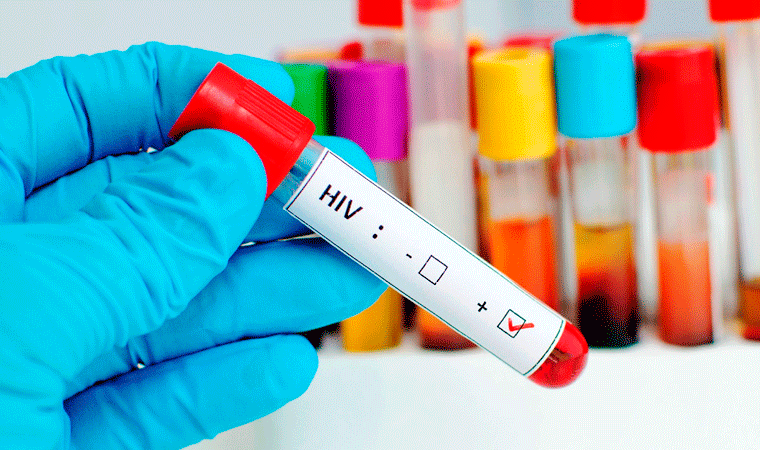 Detectan más de 300 casos con VIH este año en La Libertad