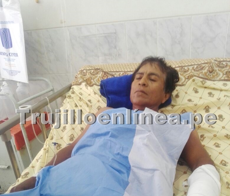 Trujillo: Agricultor atropellado pide a Melcochita que asuma su responsabilidad