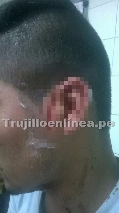 Trujillo: Taxista casi mata a joven con machete por chocar su vehículo